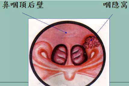 重庆甲状腺医院