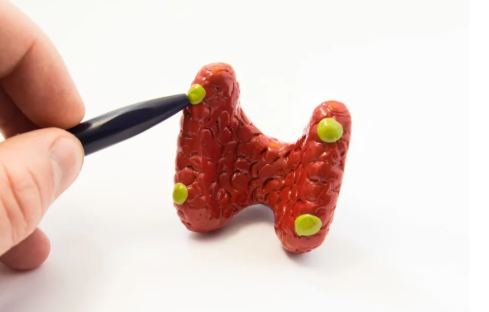 重庆甲状腺医院