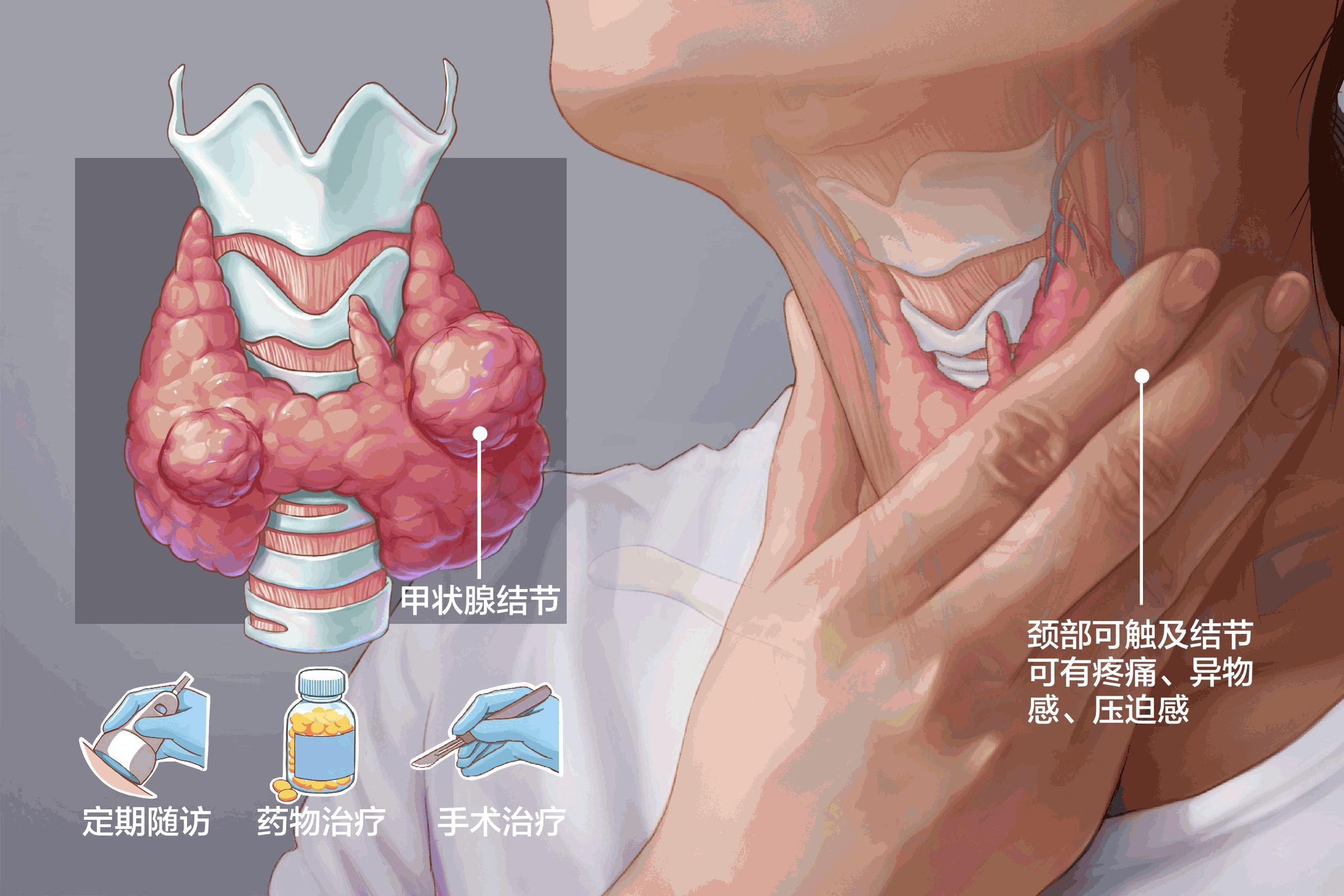 甲状腺