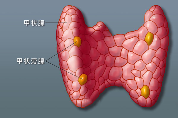 甲状腺结节
