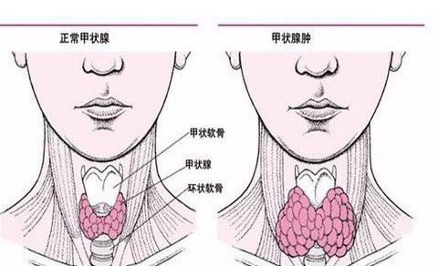 重庆甲状腺医院