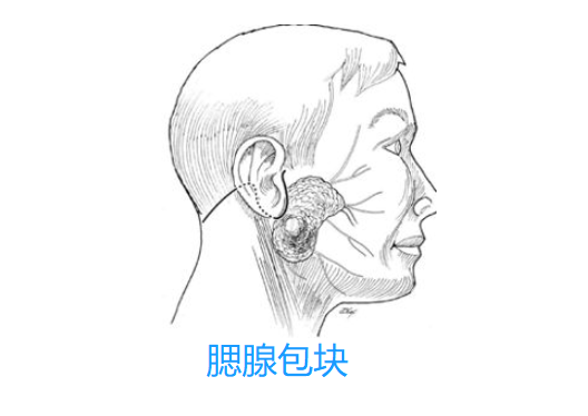 腮腺包块